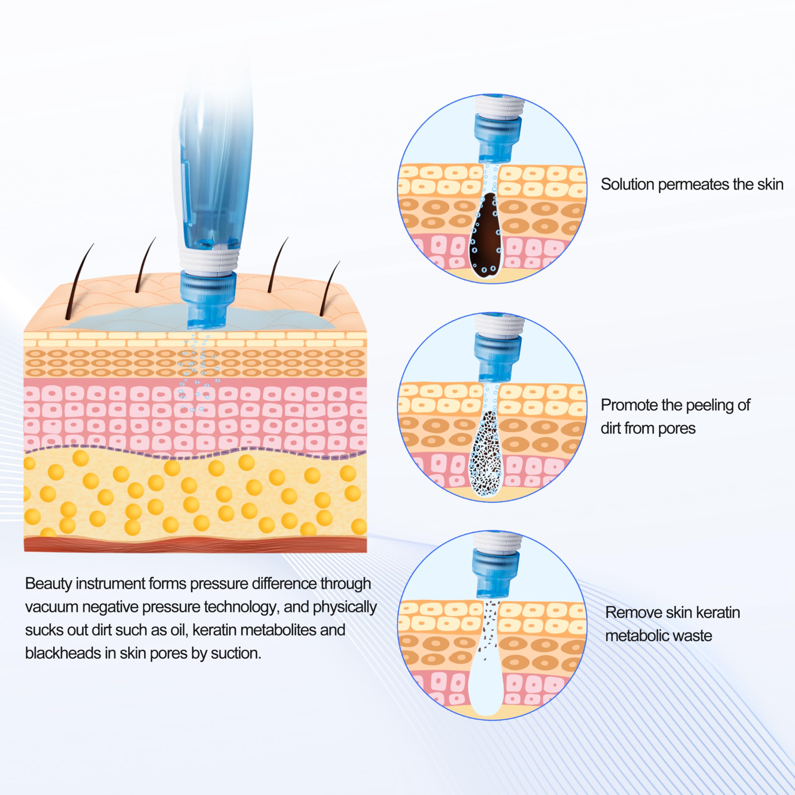 Amazon.com: Elitzia Hydro Dermabrasion Aqua Peel Machine